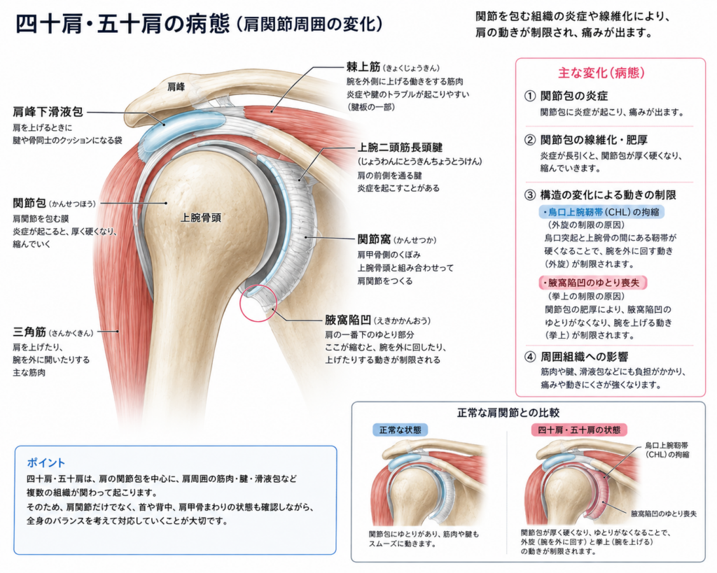 四十肩・五十肩の病態を示す肩関節の解剖図